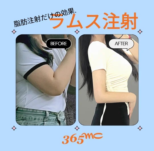 202508151022451538648.jpg
